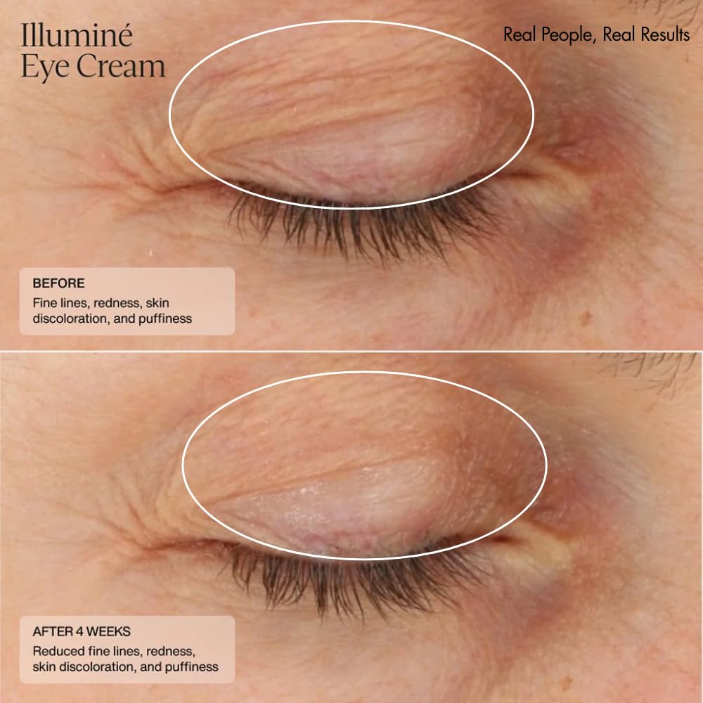 Sent Illumin Ey Crea Diminis Dar Circles Discoloration Redness an Puffines Aroun Th Eye wit Patente HSA Niacinamid an Peptide 0. Oz