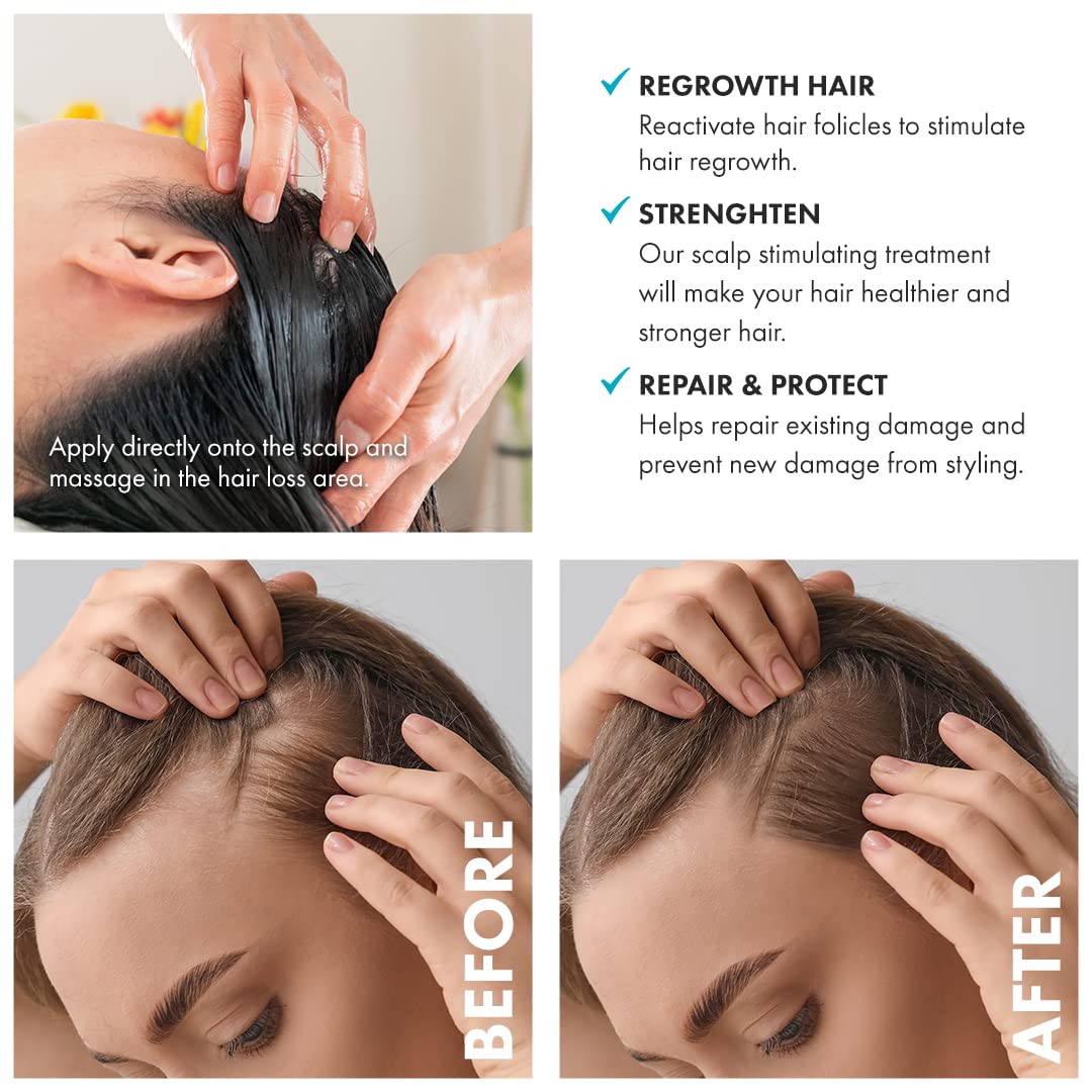 Hai Ba NY DI Diamon B0T0 Hai Treatmen Hom Ki Dee Hydratio Spli En Repair Reduce Friz Instantl an Stimulat Follicle t Sto Hai Los (Al Hai Types U t Applications