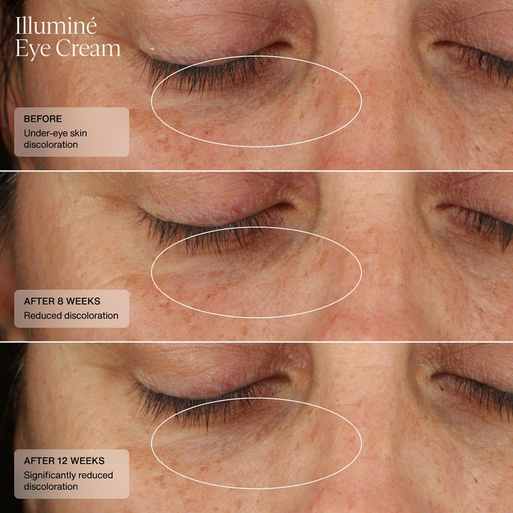 Sent Illumin Ey Crea Diminis Dar Circles Discoloration Redness an Puffines Aroun Th Eye wit Patente HSA Niacinamid an Peptide 0. Oz