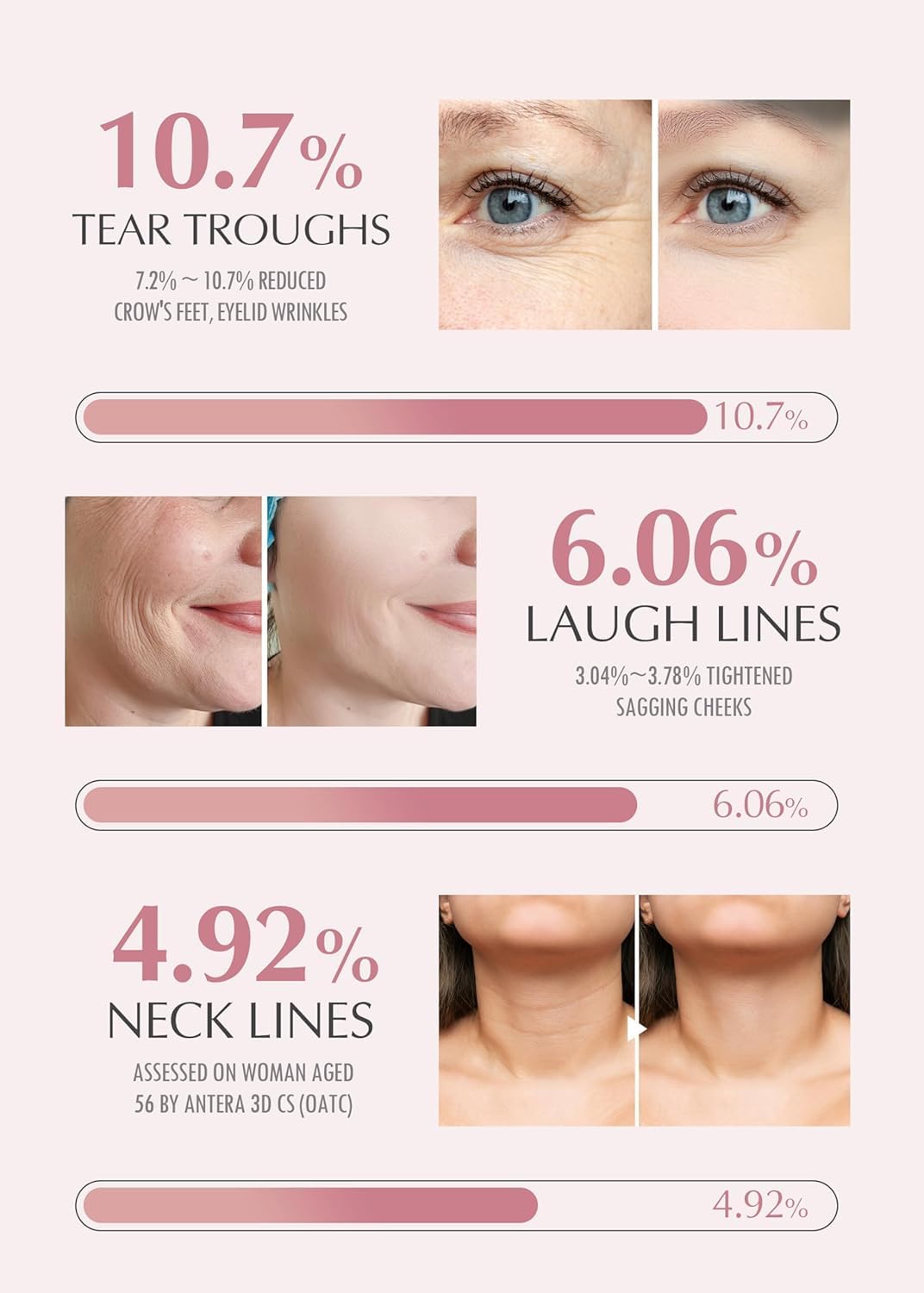 KAH Wrinkl Bounc Mult Bal DU EDITIO All-in-On Hydratin Bal Ey Crea Mak U Bas Moistur Stic Dail Moisturize Stic wit Salmon-derive sodiu DN (0.3 o Pac o 2)