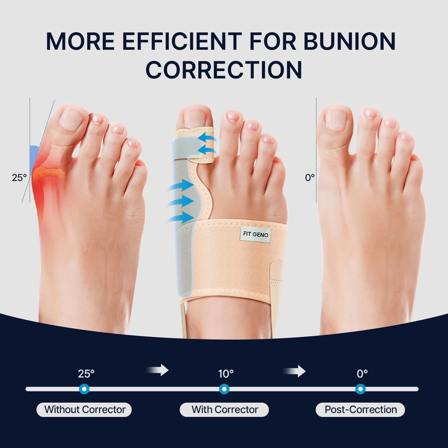 Fit Geno Bunion Corrector for Women & Men - Adjustable Big Toe Separator for Pain Relief - Orthopedic Toe Corrector for Hallux Valgus - Day & Night Support - 1 Pair
