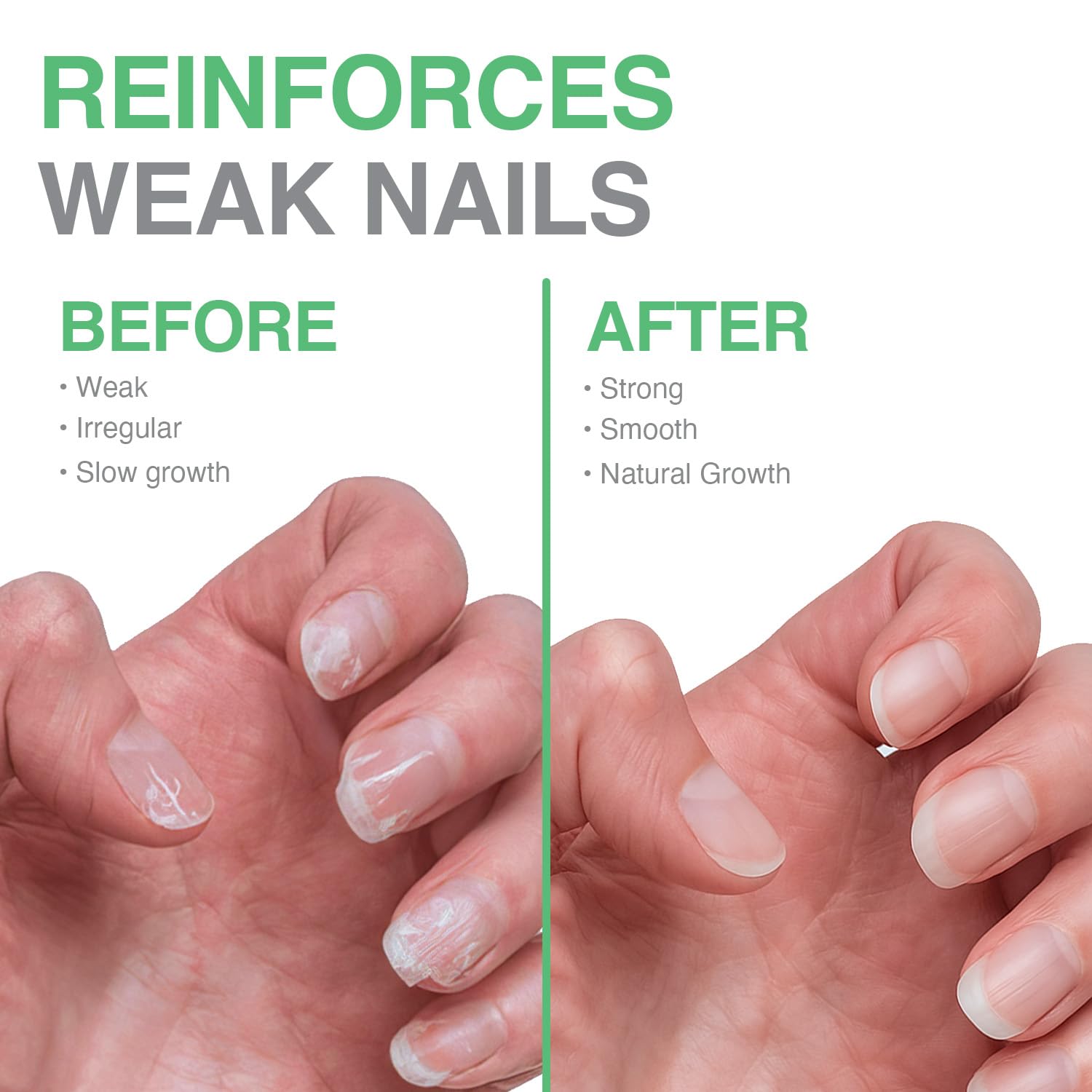 Probelle Nail Maintenance Formula 2, Nail Hardener and Strengthener for soft, brittle, and splitting nails - Reinforces, protects, conditions, strengthens, grows fingernails 5 fl oz/ 15 mL