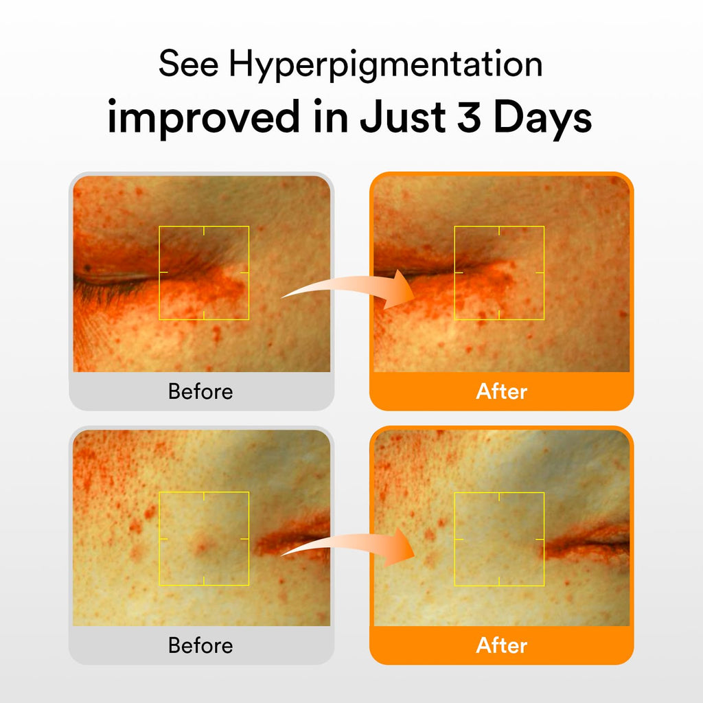 Abib Glutathiosome Dark Spot Serum Vita drop 1.69 fl.oz. | Korean Skincare, Dark Spot, Hyperpigmentation Treatment | Serum for Sensitive, Uneven Skin