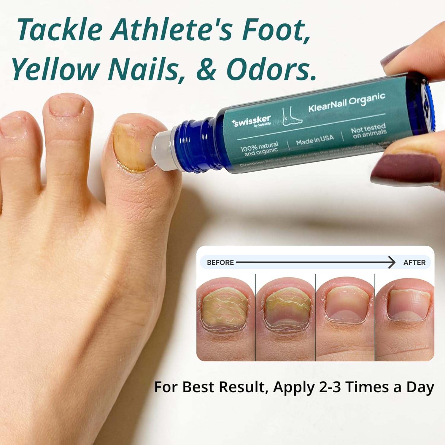 Swissklip KlearNail Toenail Stick | Medi-Care Treatment | Natural Solution for Healthy Nails I Suitable For Foot, Toe, and Fingernail I For Brittle Toenails ¨C 10ml / 0.3 Fl. Oz. Pack 1 - Made in USA