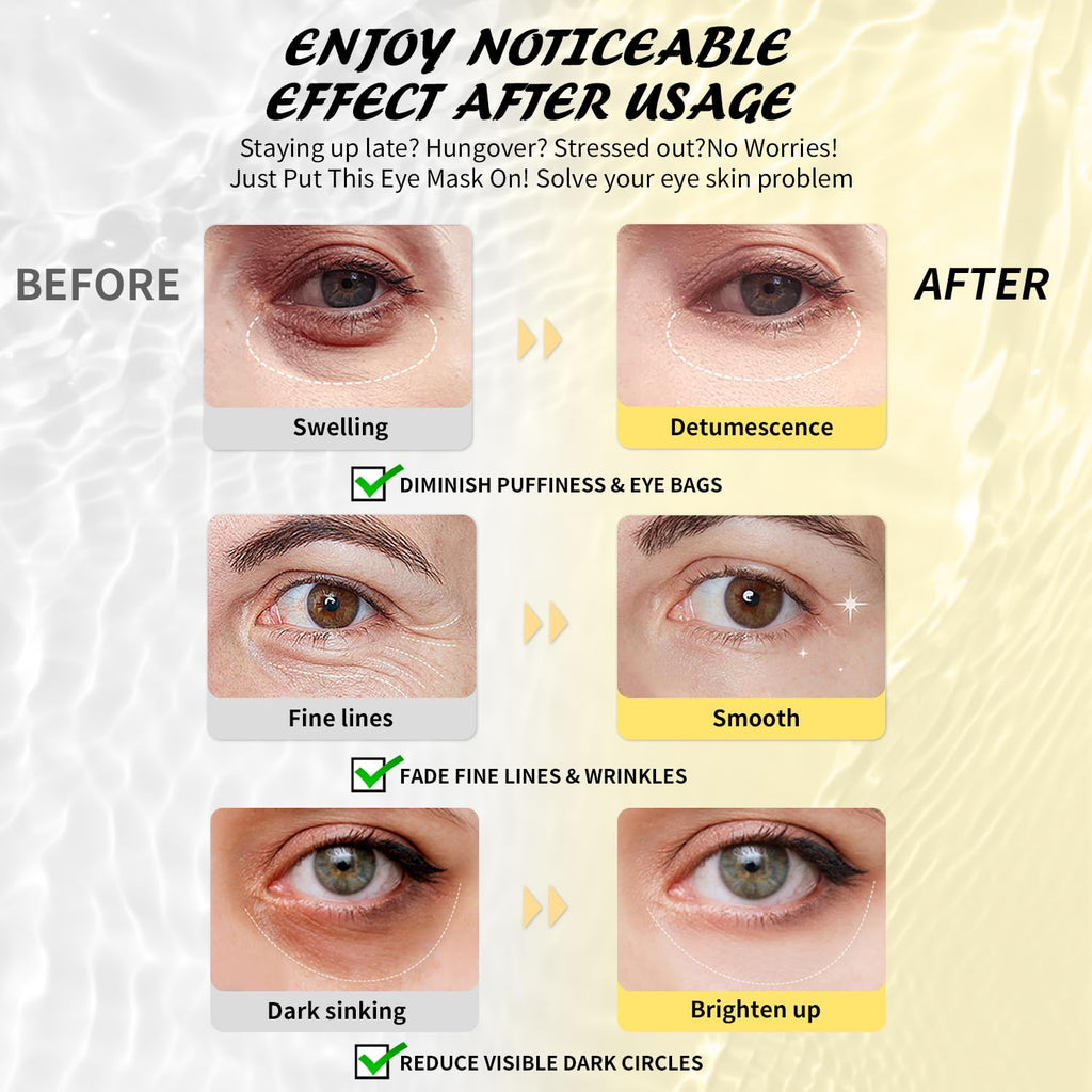 Under Eye Patches (15 Pairs), Stocking Stuffers for Women, 3 Colors Eye Masks Gift Set for Dark Circles Puffy Eyes, Undereye Bags and Wrinkles, Vegan Skin Care Gifts for Teen Girls