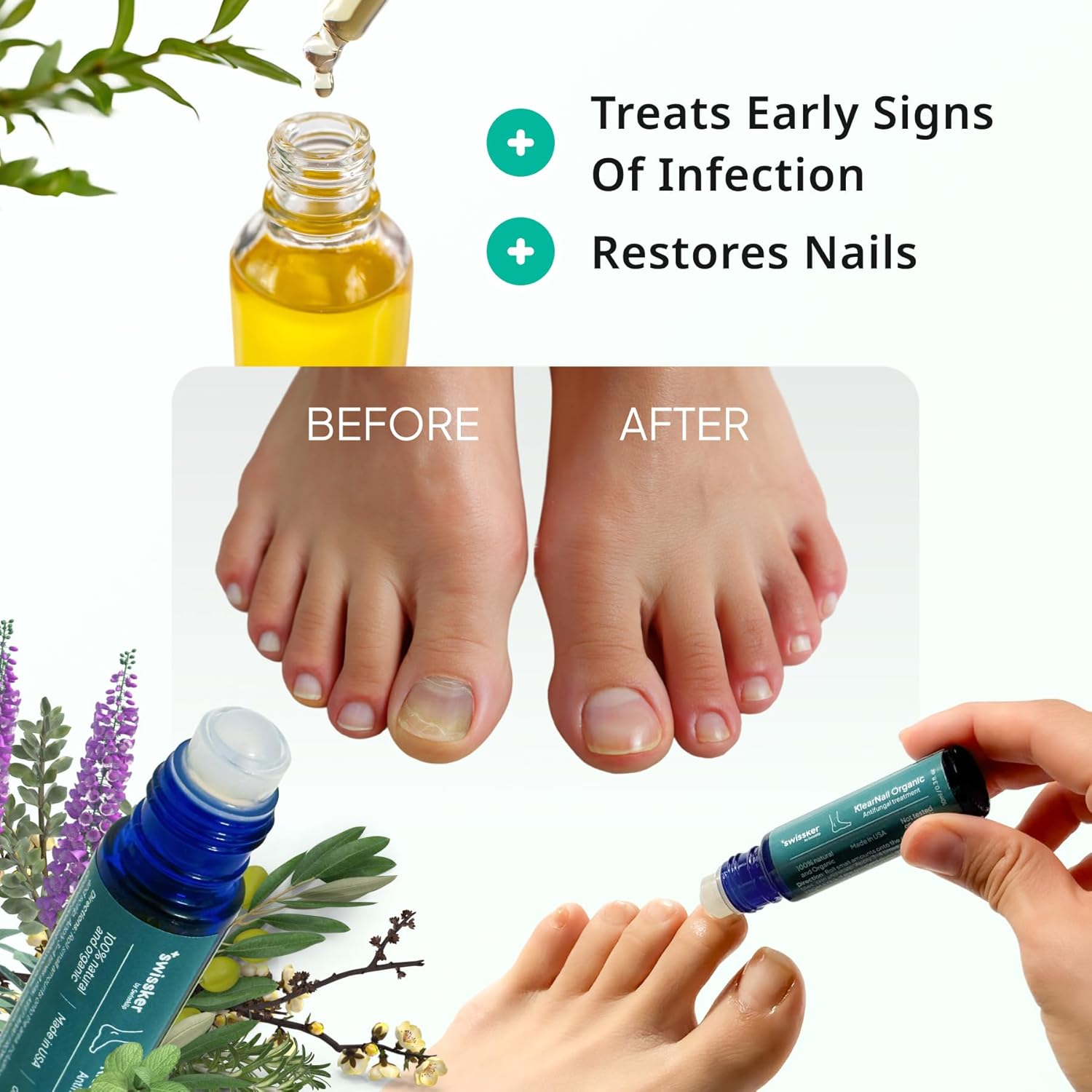 Swissklip KlearNail Toenail Stick | Medi-Care Treatment | Natural Solution for Healthy Nails I Suitable For Foot, Toe, and Fingernail I For Brittle Toenails ¨C 10ml / 0.3 Fl. Oz. Pack 1 - Made in USA