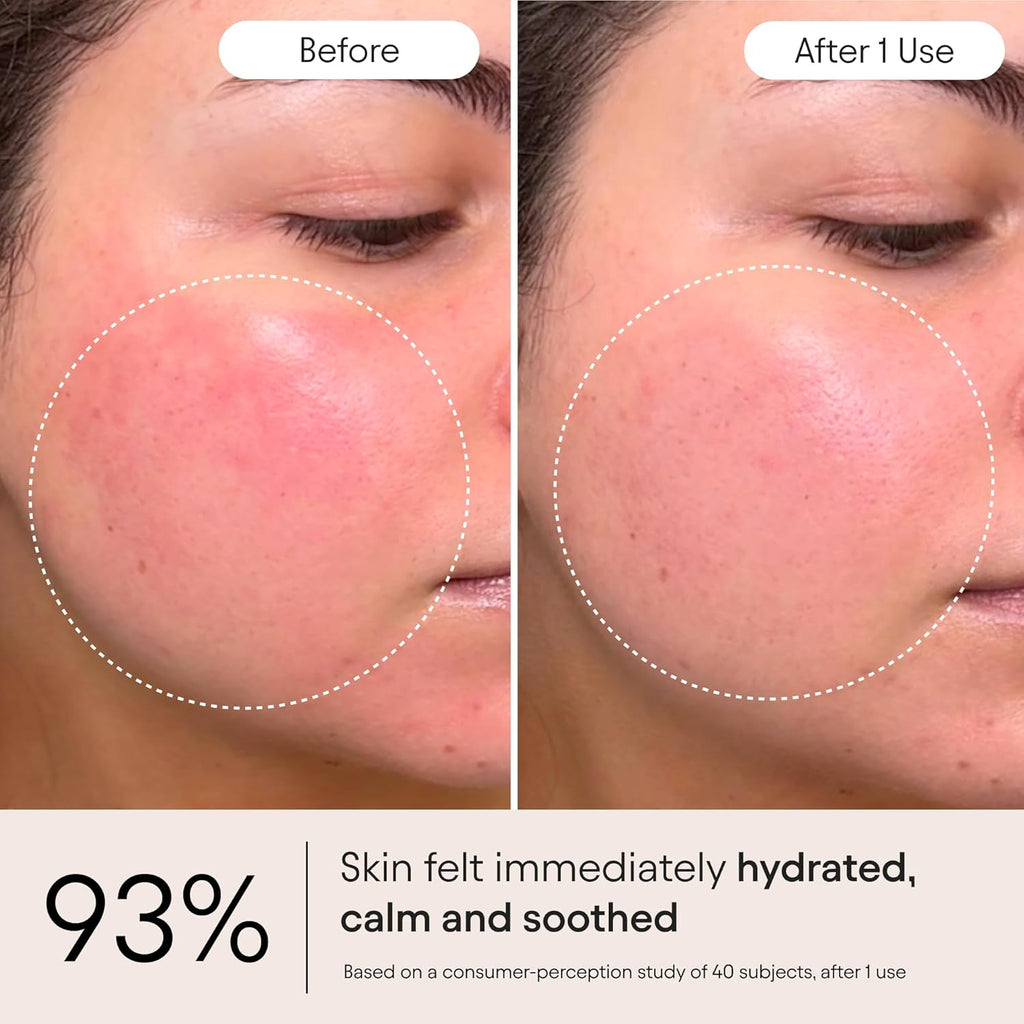 Alpy Supe Peptid Ghostberr Moisturize fo Eczema Barrie Wrinkl Repai Cal Sooth Agains Rednes Irritatio 1. o 5 ml