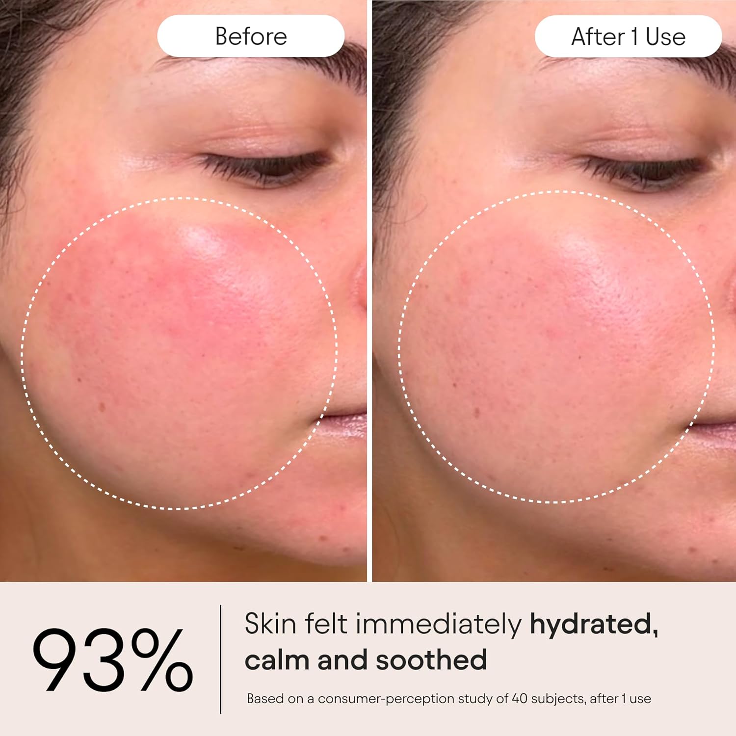 Alpy Supe Peptid Ghostberr Moisturize fo Eczema Barrie Wrinkl Repai Cal Sooth Agains Rednes Irritatio 1. o 5 ml