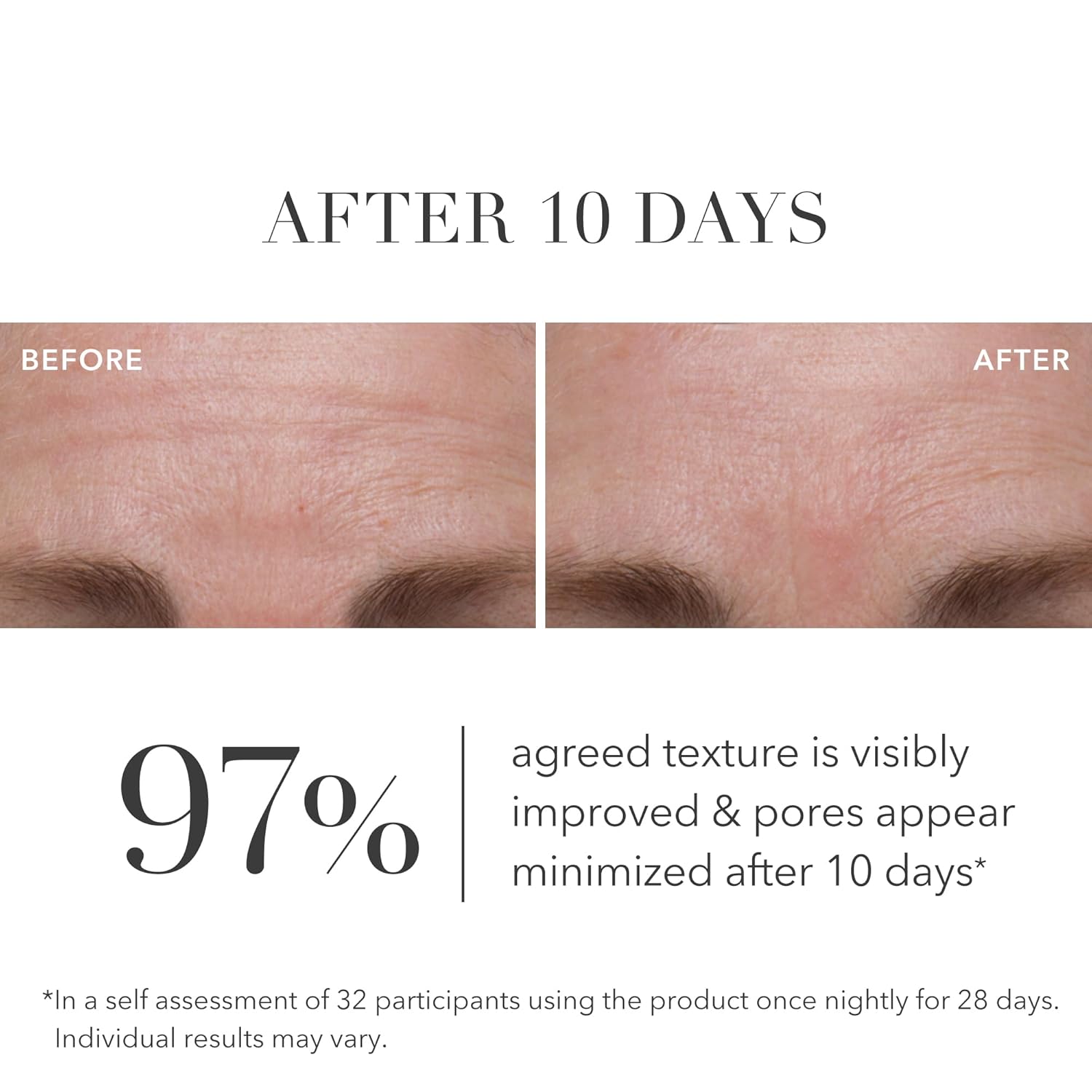 Algenis Gree Microalga Retinol Regeneratin Seru Ant Agin Seru wit Plan Based Time-Releas Retino Even Textur Visibl Reduce Dee Line Wrinkle wit Minima Irritatio ( oz)