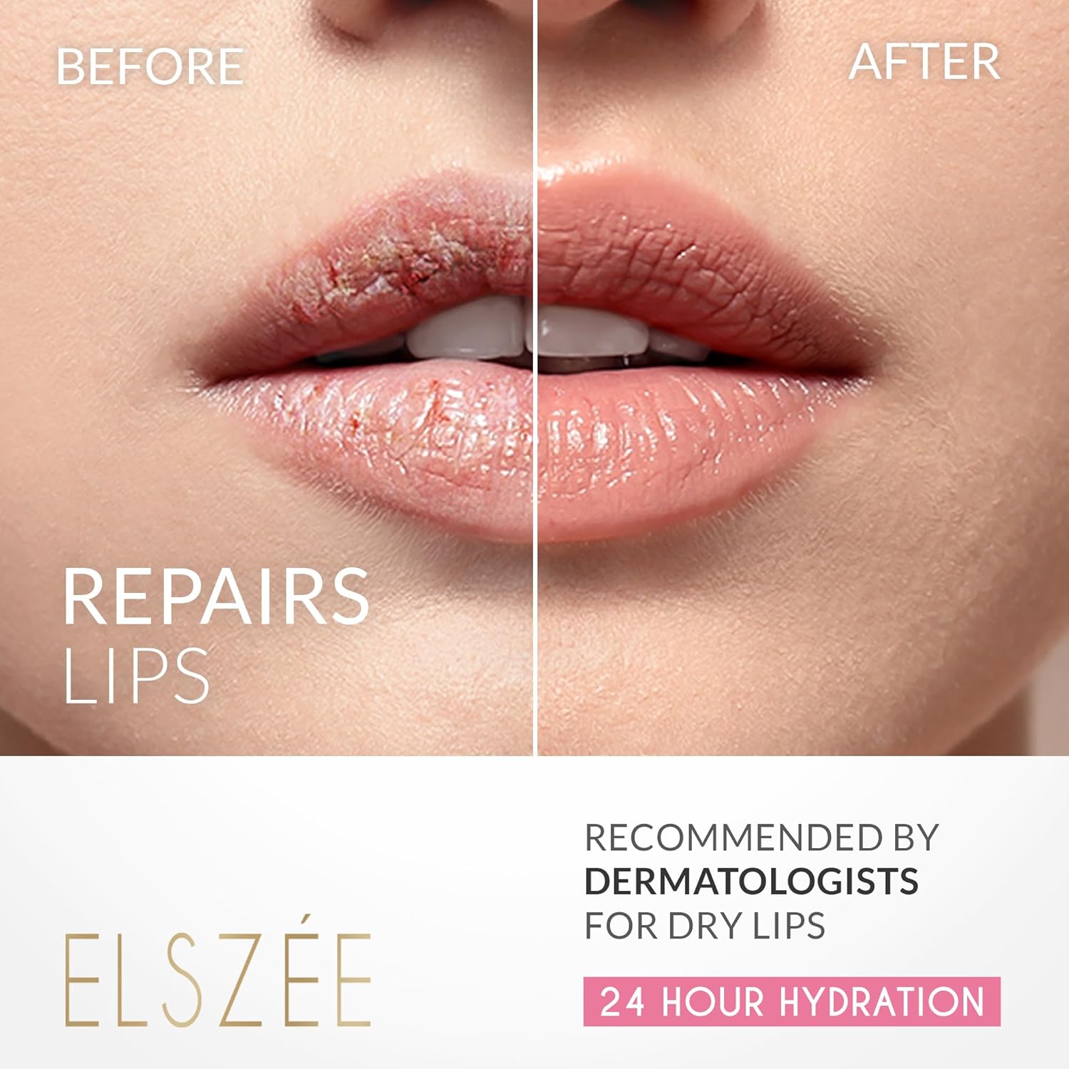 ELSZ¨¦ Loveabl Lip Li Mas wit Hyaluroni Aci Smooth Volumiz an Hydrat Dr Lip Da Nigh Treatment