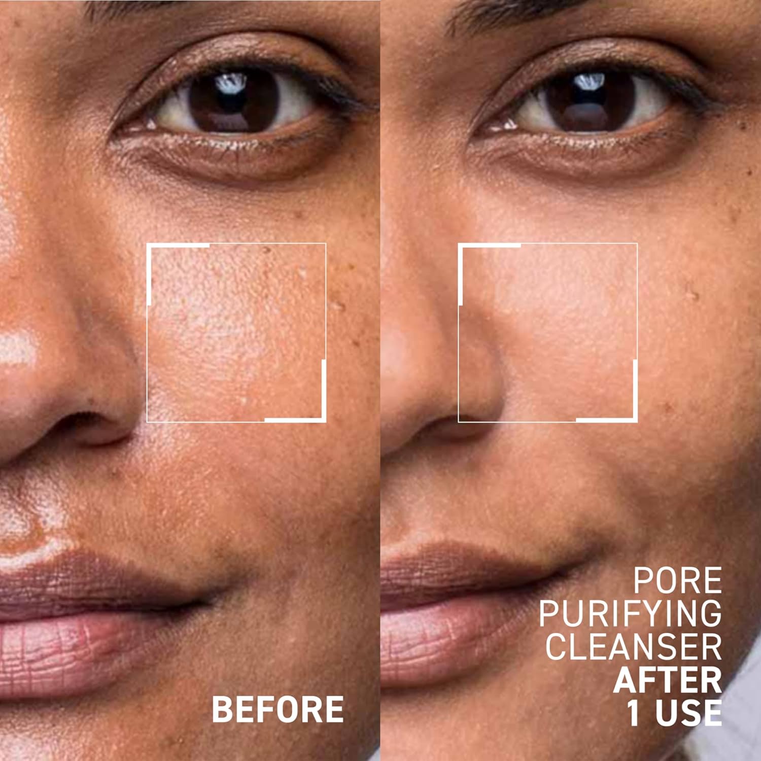 Dr Brand Pore N More Por Purifyin Cleanse Non-Dryin Ge Help t Minimiz th Appearanc o Pore Dissolve Impuritie 3. f oz Pac o 2