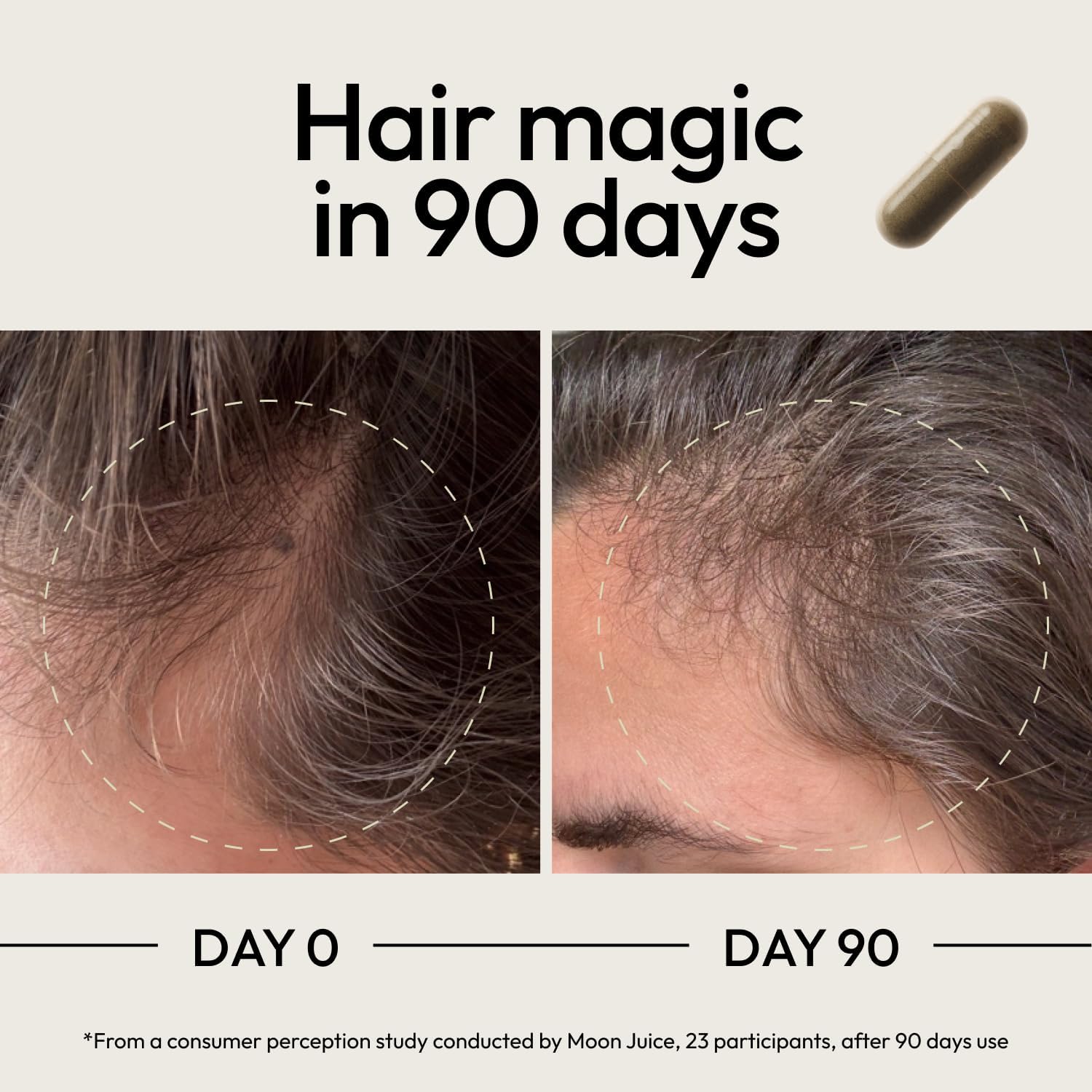 Moo Juic SuperHai Hai Growt Vitamin fo Wome Me wit Bioti Sa Palmett Clinica Strengt Multivitami Hai Supplemen fo Healthier Stronger Thicke Hair 12 Capsule 3 Servings
