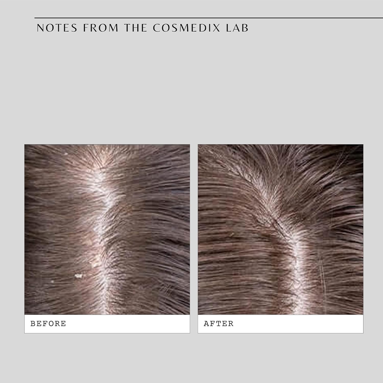 COSMEDI Fortif Coolin Enzym Scal Treatment ct.