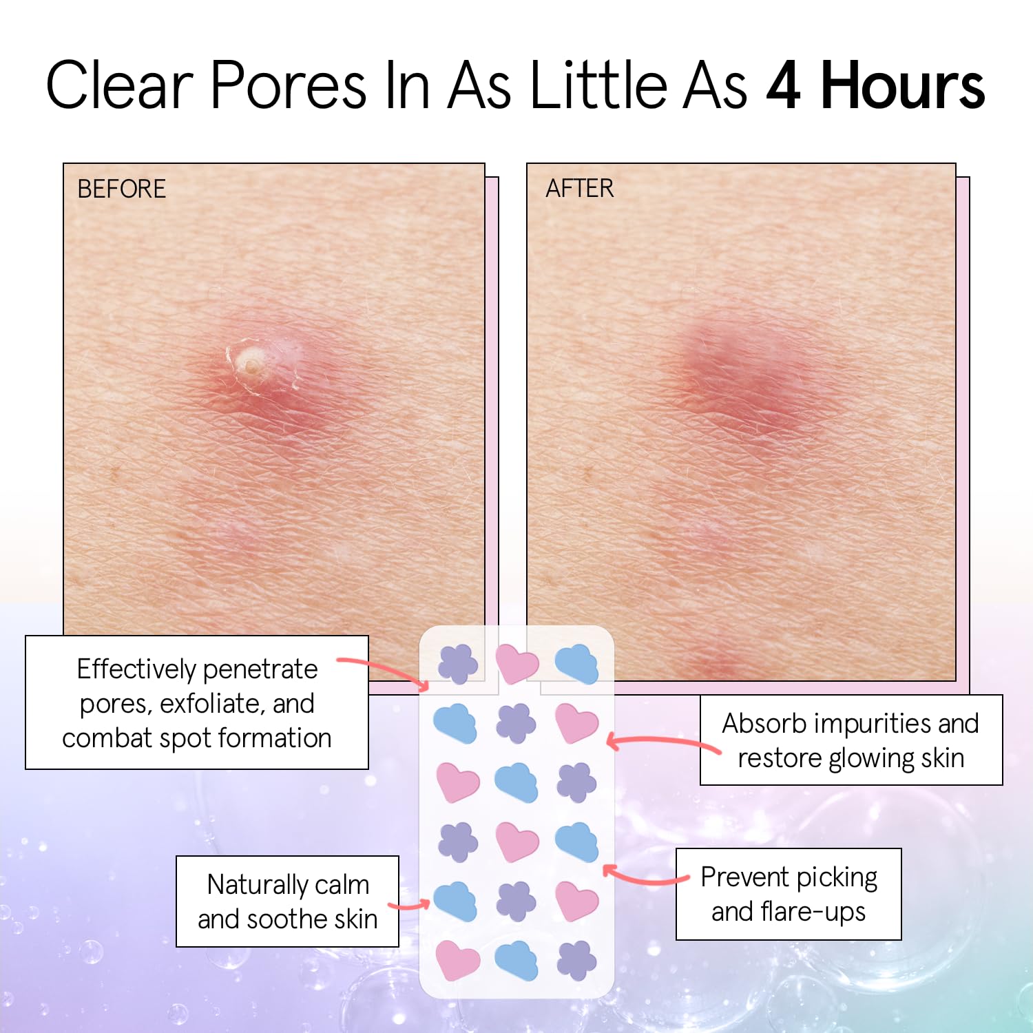 grac stell Awar Winnin Por Stri Pimpl Patche fo Fac Hydrocolloi Acn Patche Absorb Zits Reduce Rednes Cut Patche Dermatologist-Tested Vega (Multishape 3 Count)