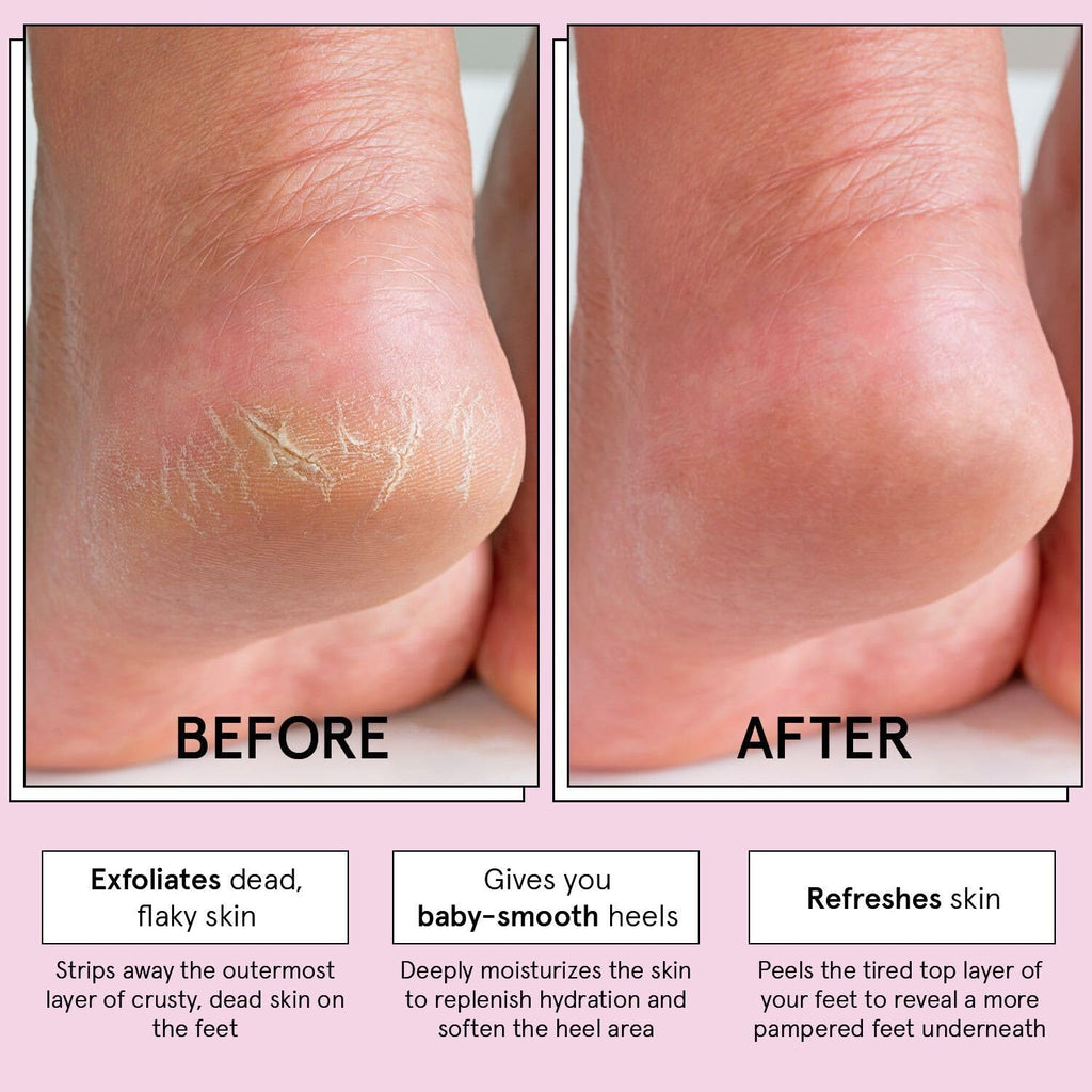 grace stella Award-Winning Foot Peel Mask - Foot Peeling Mask with Aloe Vera - Moisturizing Foot Mask for Dry Cracked Feet - Foot Exfoliator for Baby Soft Feet (2 Pairs, Lavender)
