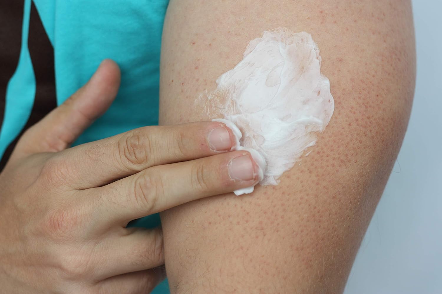 K Element Keratosi Pilari Lotio ( f oz Natura Keratosi Pilari Treatment Moisturizin Exfoliatin AH Lotio fo KP Vegan Mad i USA
