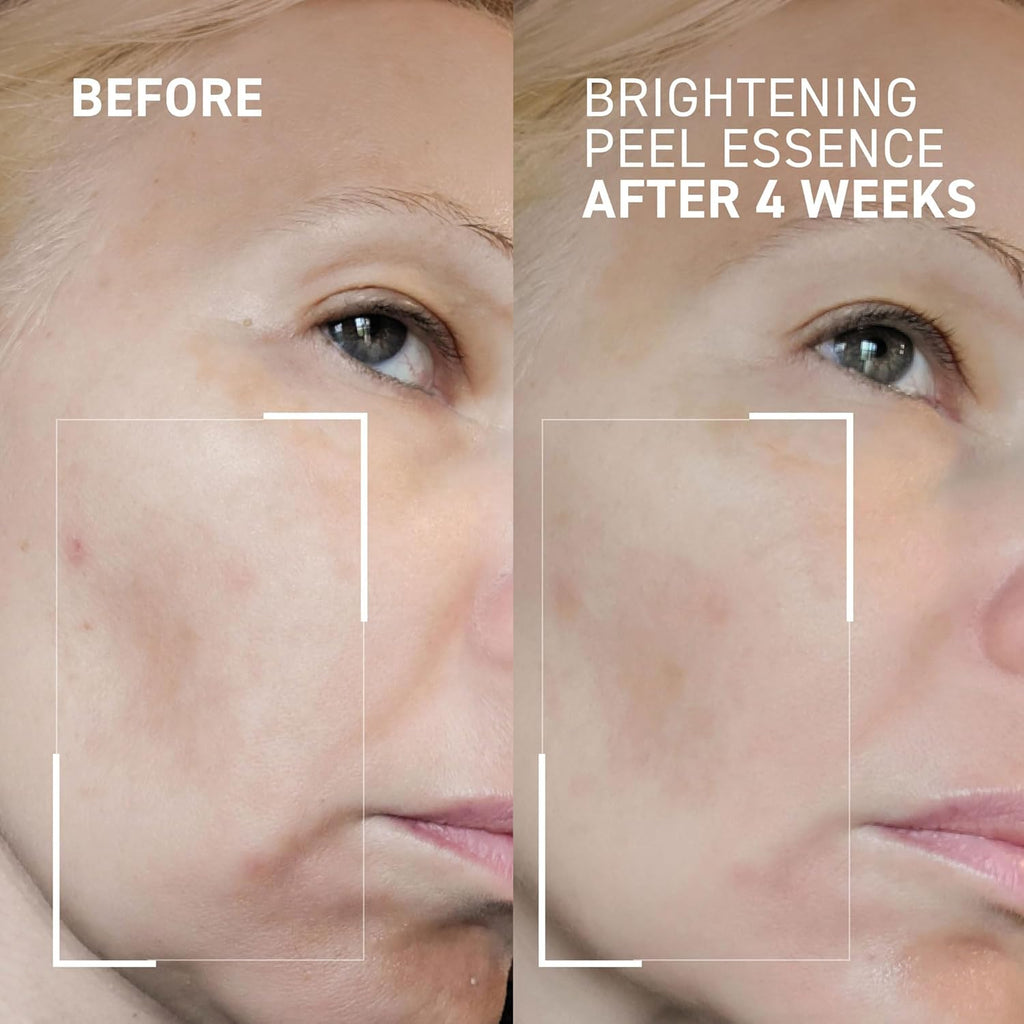 Dr. Brandt Dr. B Lab Brightening Peel Essence - Evens Skin Tone, Smooths Skin Texture Improves Radiance - 3.4 fl oz, Pack of 2