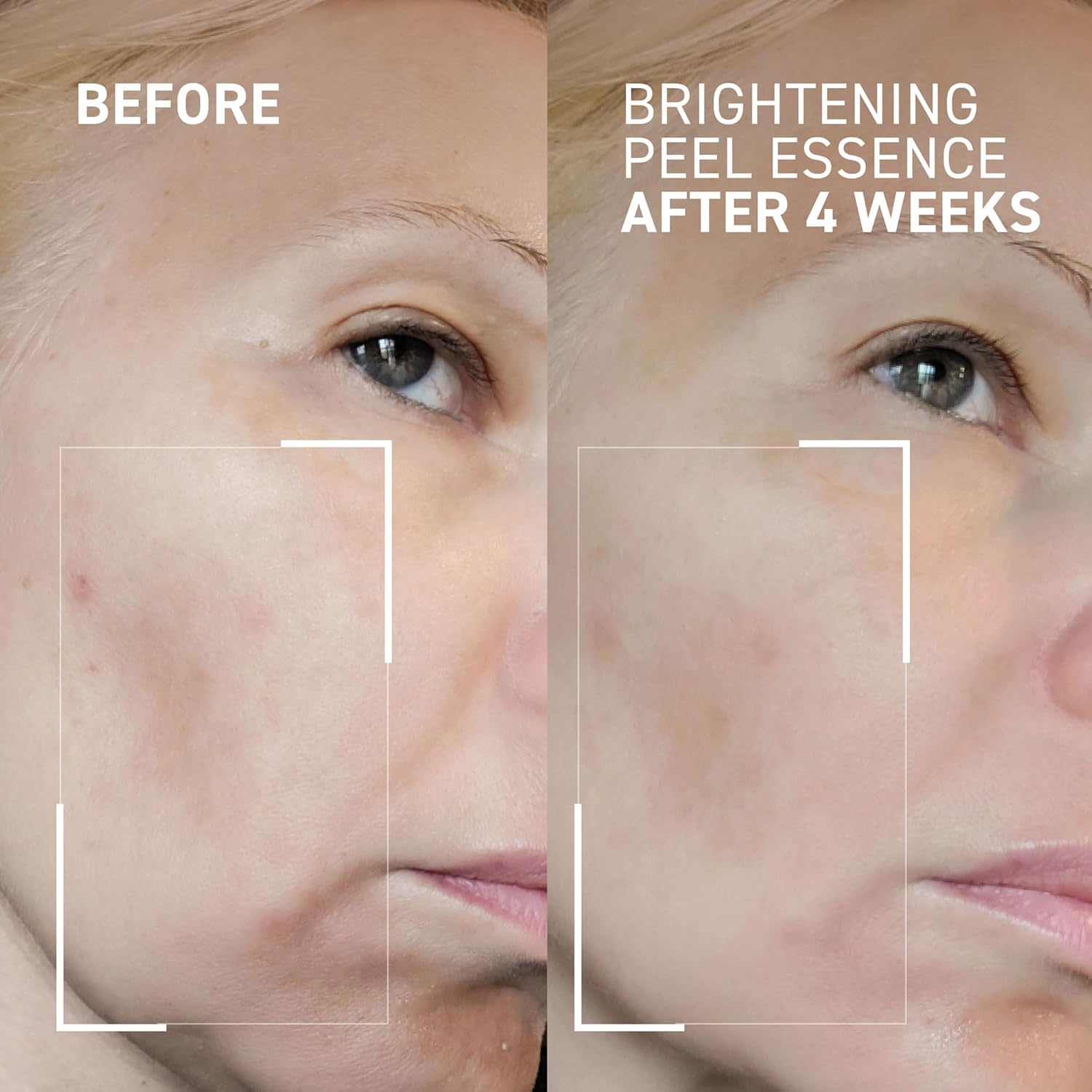 Dr. Brandt Dr. B Lab Brightening Peel Essence - Evens Skin Tone, Smooths Skin Texture Improves Radiance - 3.4 fl oz, Pack of 2