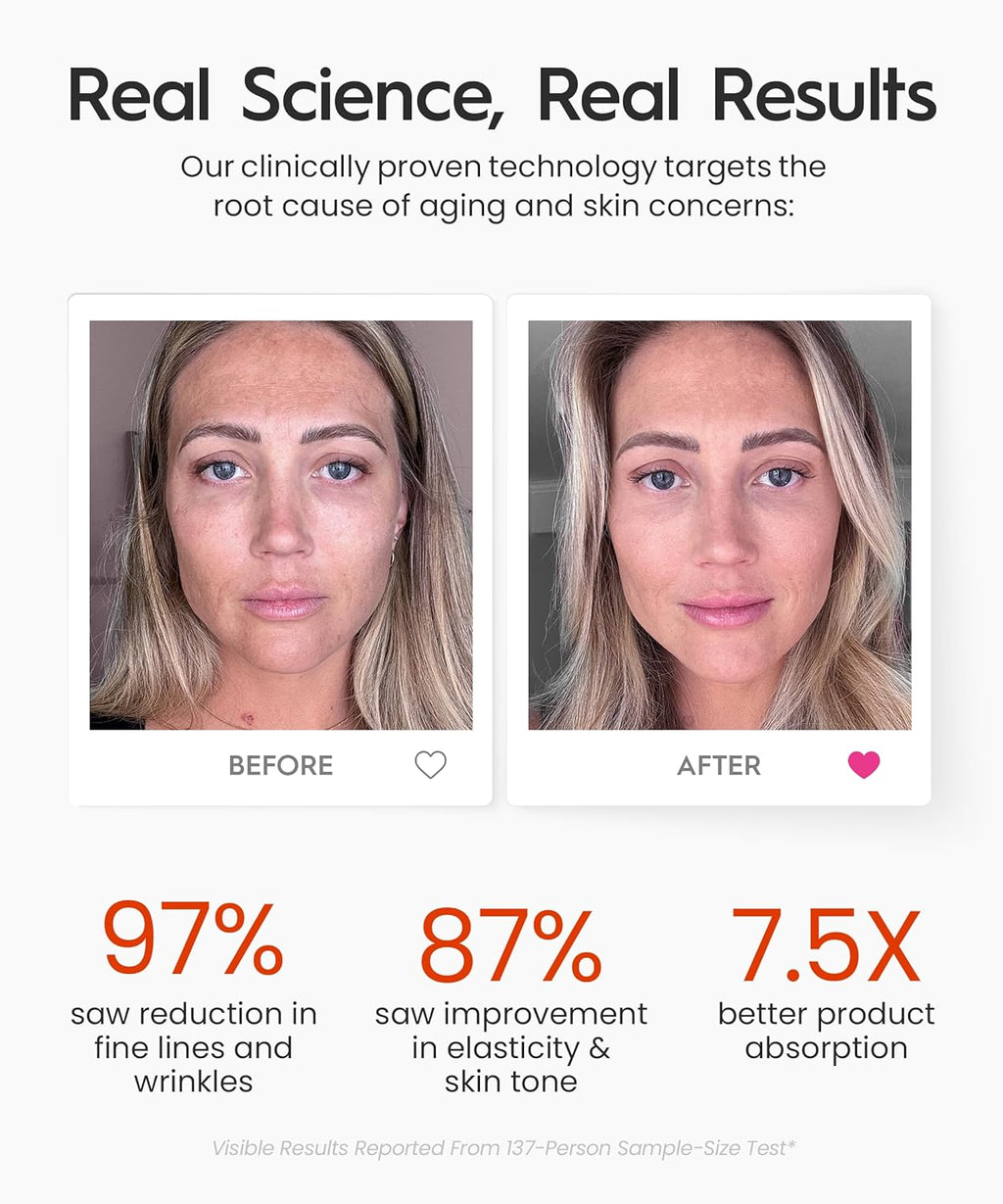 REV Geni 3-in- Fac Nec Beaut Massage wit Heat Ligh Therapies Smar Vibratio Re Light Blu Light Gree Ligh Therap fo Wrinkles Hyperpigmentation Acn Mor Beige
