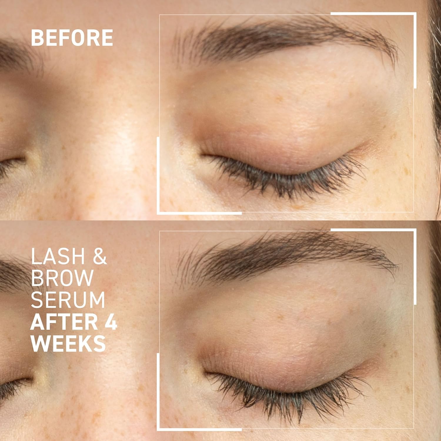 Dr. Brandt Dr. B Lab Lash Brow Serum - Growth Conditioning Formula for Longer, Fuller Hair Follicles - 0.17 fl oz, Pack of 2