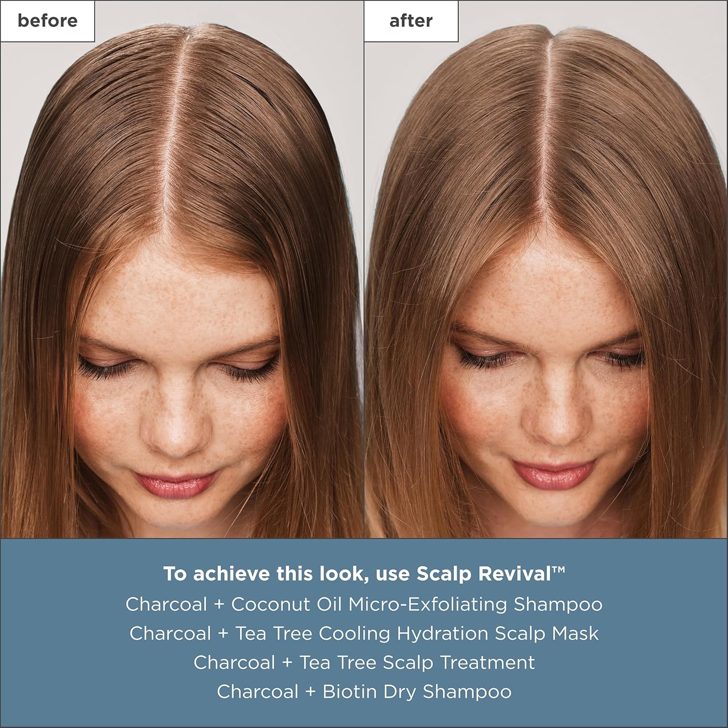 Brioge Scal Reviva Charcoa Te Tre Scal Treatment Scal Seru t Sooth Dry Flaky Itch Scalp Absor Oil Hydrat Dr Scalp Clarif Buil Up Vegan Cruelty-Free f oz