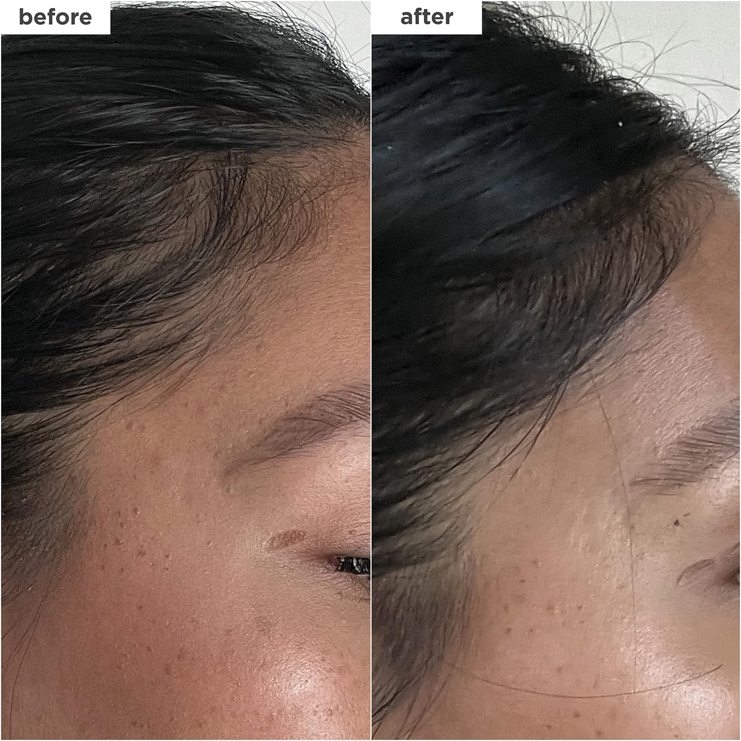 Brioge Destine Fo Densit MegaStrength Caffein Bioti Peptid Densit Serum Increase Hai Thicknes an Volume Fast-Absorbin Non-Greasy Fragrance-Free Vegan Cruelty-Free 1. f oz