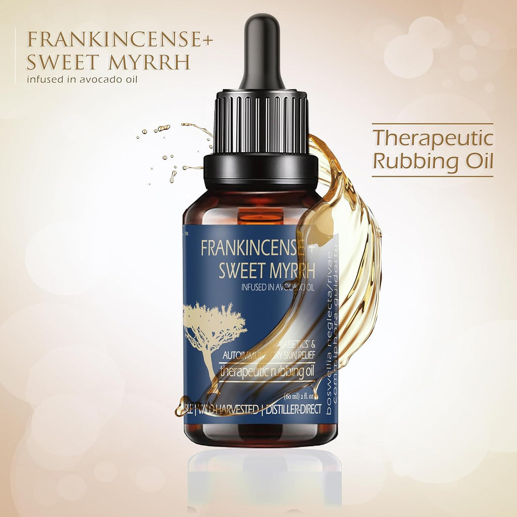 BALM OF GILEAD Neuropathy Frankincense Sweet Myrrh Therapeutic Rubbing Oil - Instant Diabetic's Autoimmune Dry Skin Relief Repair, 2 fl oz
