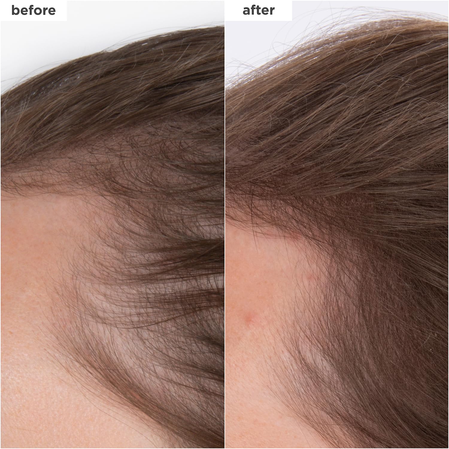 Brioge Destine Fo Densit MegaStrength Caffein Bioti Peptid Densit Serum Increase Hai Thicknes an Volume Fast-Absorbin Non-Greasy Fragrance-Free Vegan Cruelty-Free 1. f oz