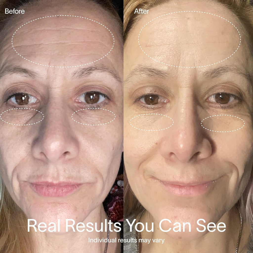 Solawav Re Ligh Therap Mas fo Fac Re Near-Infrare Le Ligh Devic Reduce Appearanc o Fin Line Wrinkle Improve Firmness Elasticity Textur 10-Mi Anti-Agin Treatment