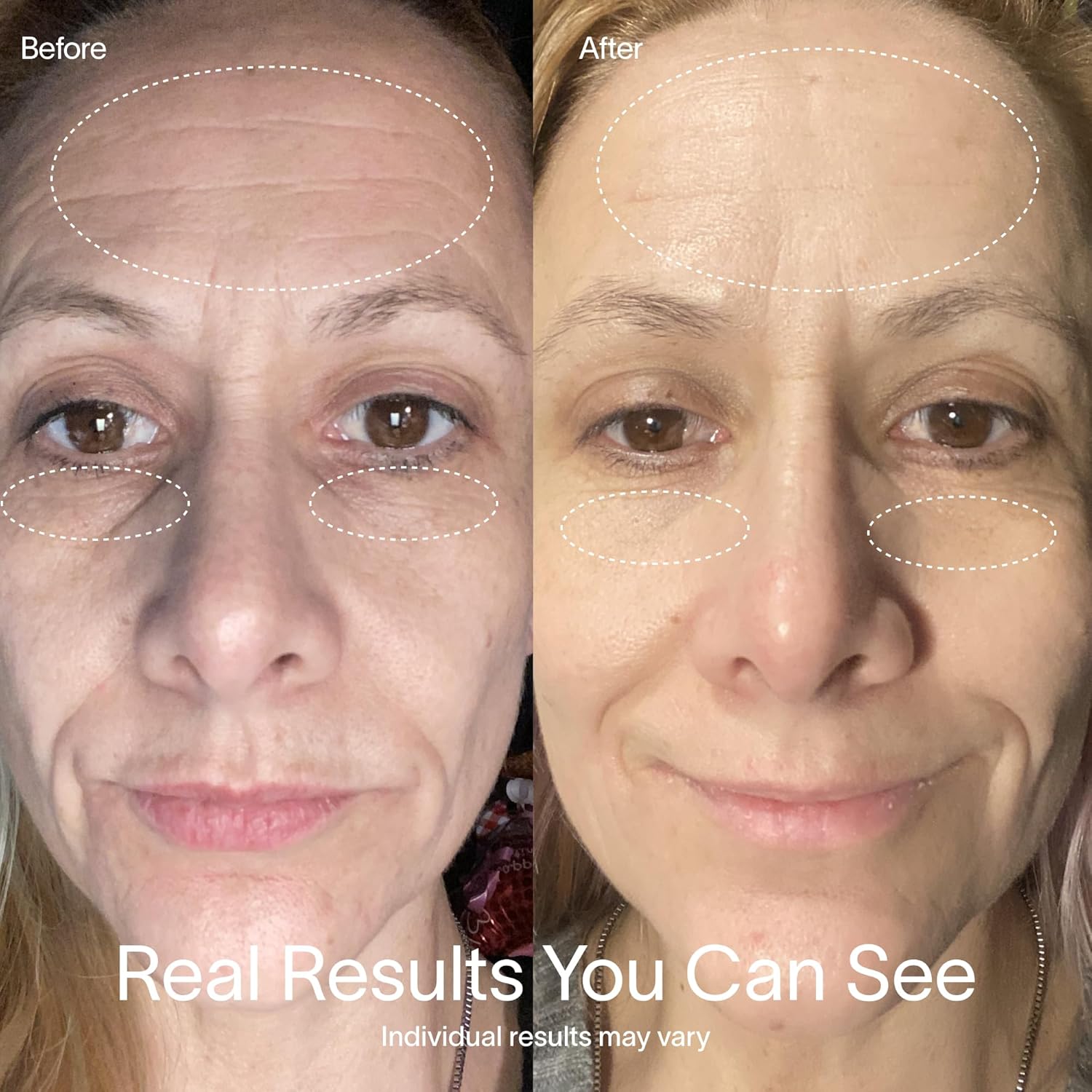 Solawav Re Ligh Therap Mas fo Fac Re Near-Infrare Le Ligh Devic Reduce Appearanc o Fin Line Wrinkle Improve Firmness Elasticity Textur 10-Mi Anti-Agin Treatment