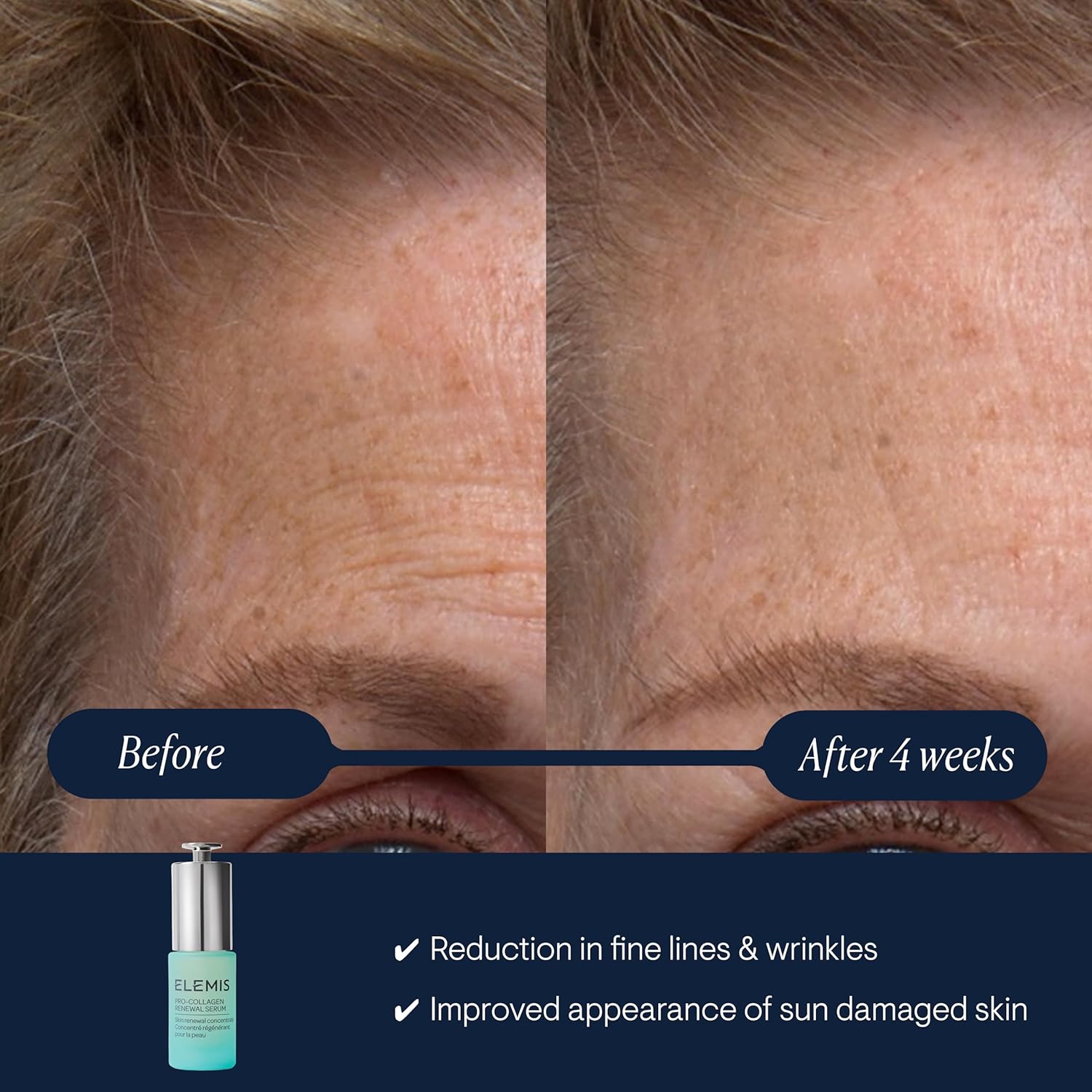 ELEMI Pro-Collage Renewa Seru 15ml Gentl Retino Alternativ fo Smoothin Fin Line Wrinkles