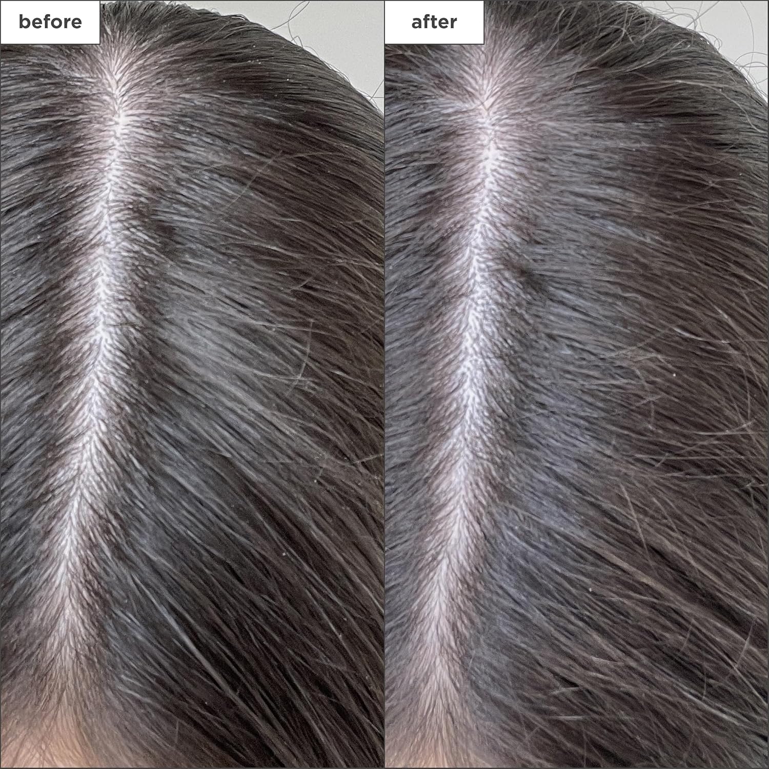 Brioge Scal Reviva Charcoa Bioti Dr Shampoo Clarifyin Shampo Scal Cleanse fo Dr Scal Itch Scalp Featurin Te Tre Oi fo Hair Vegan Cruelty-Free 1. oz