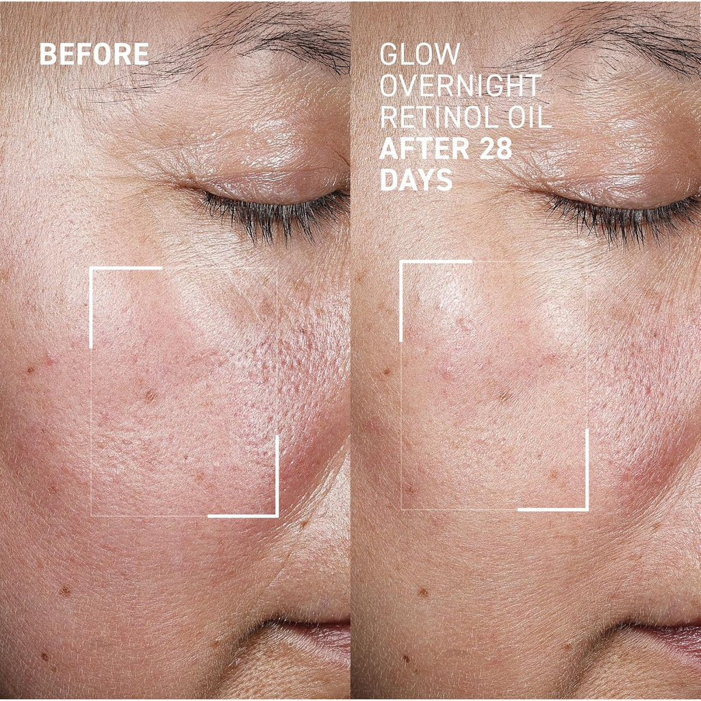 Dr. Brandt Bright This Way Glow Overnight Retinol Oil - Pure 2% Retinol Improves Wrinkles, Lines Skin Texture - 1 fl oz