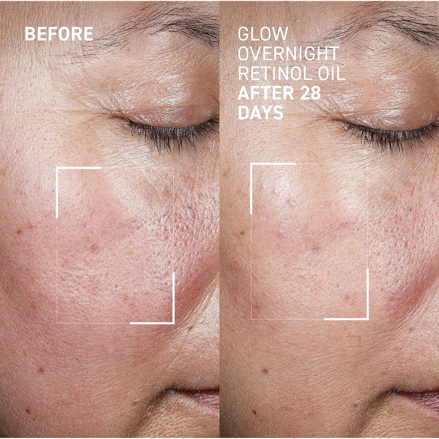 Dr. Brandt Bright This Way Glow Overnight Retinol Oil - Pure 2% Retinol Improves Wrinkles, Lines Skin Texture - 1 fl oz