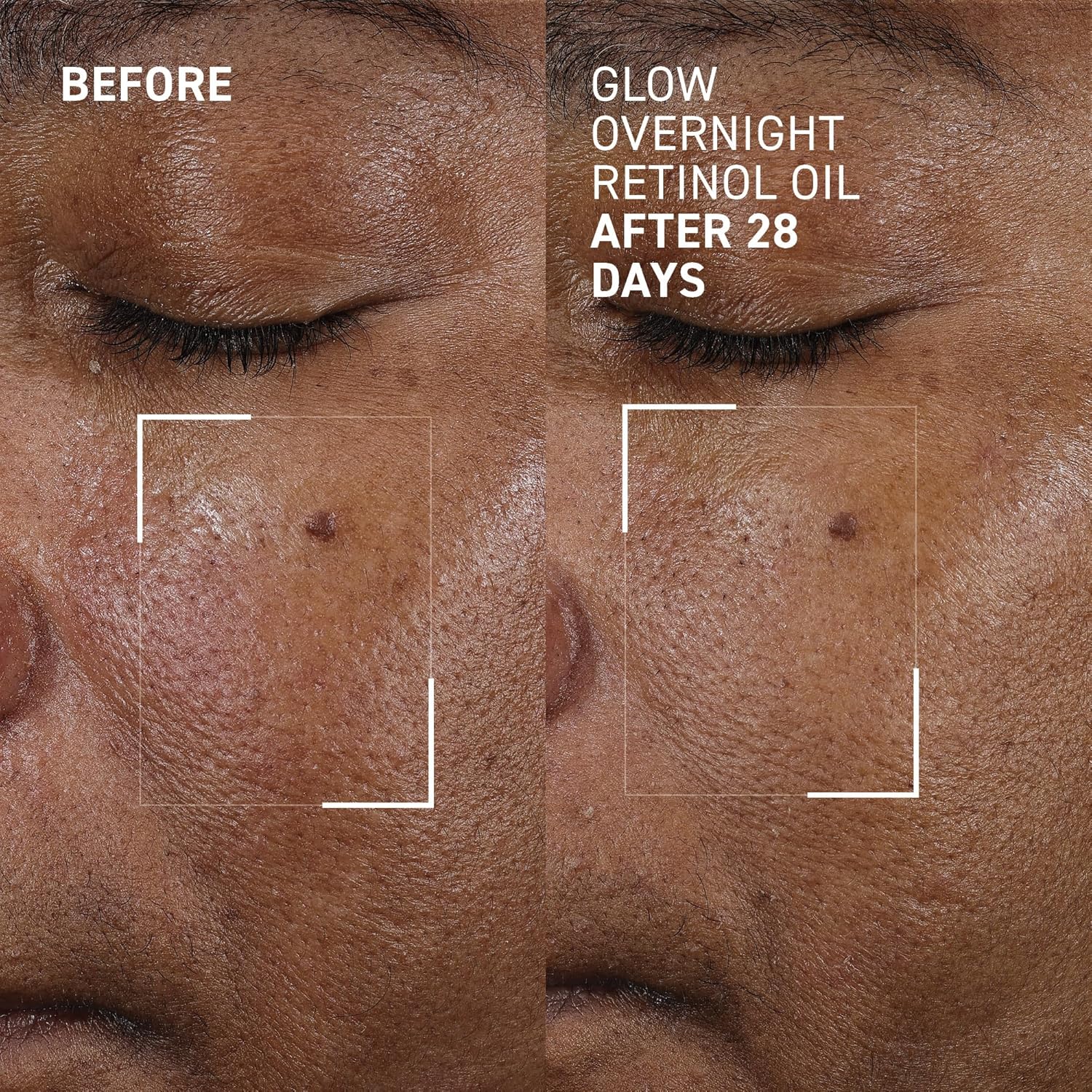 Dr. Brandt Bright This Way Glow Overnight Retinol Oil - Pure 2% Retinol Improves Wrinkles, Lines Skin Texture - 1 fl oz